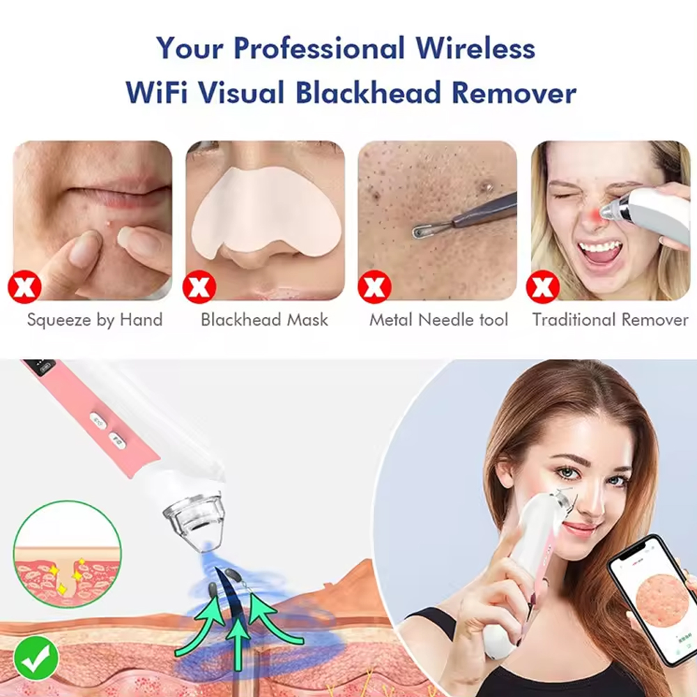 Вакуумный Очиститель пор, устр – обзор и цена Nasal Aspirator